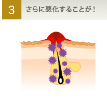 さらに悪化することが!