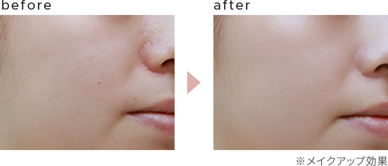 before - after