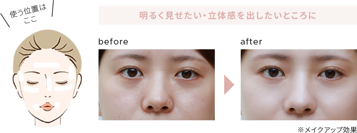 before - after
