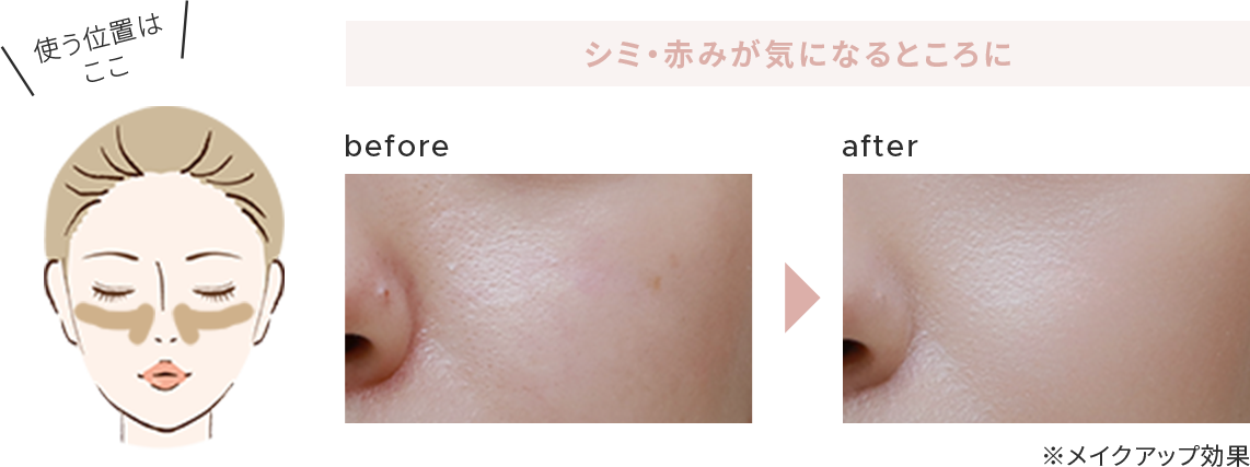before - after