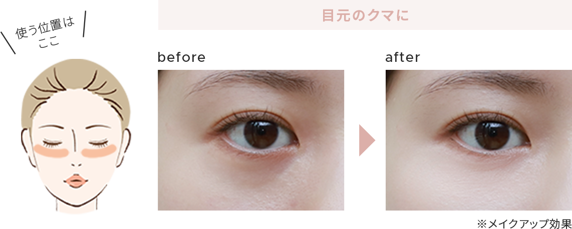 before - after